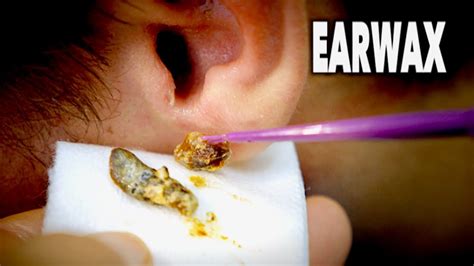 Ear Better Wax Removal & Hearing Care